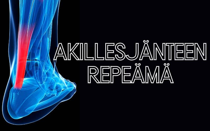 akillesjänteen repeämä leikkaus vai ei